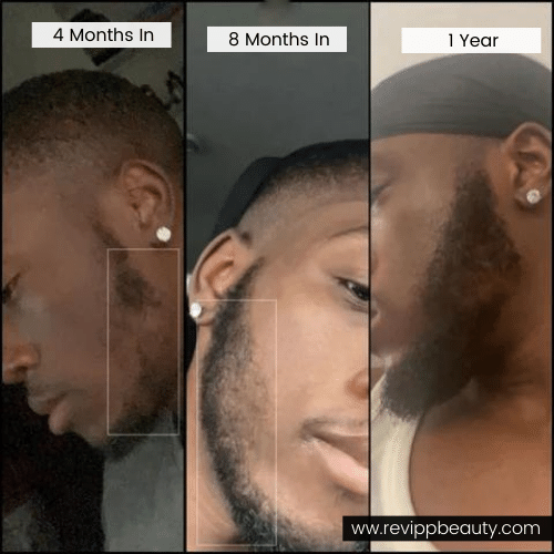 Revipp Beauty Hair Products, one year hair growth journey